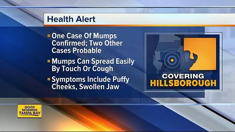 One case of mumps confirmed in Hillsborough County, 2 other probable cases identified