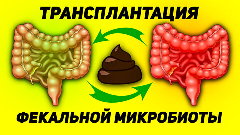 Фекальная микробиота как альтернатива таблеткам