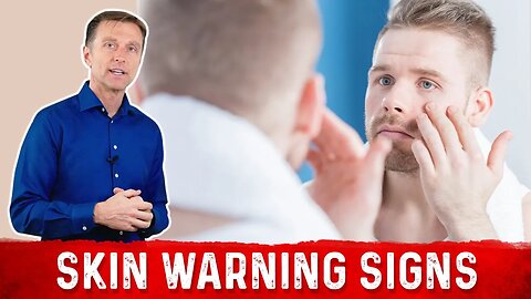 7 Skin Warning Signs of Diabetes