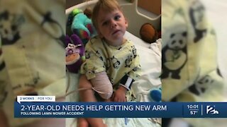 2-year-old needs help getting new arm