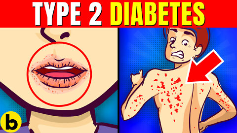 Don’t Ignore These 13 Early Warning Signs Of Type 2 Diabetes