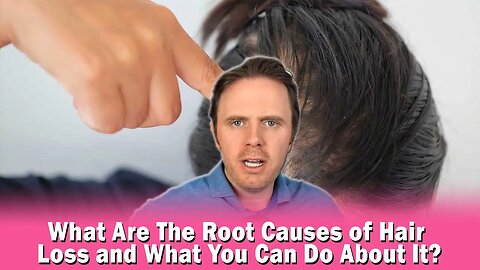 What Are The Root Causes of Hair Loss and What You Can Do About It?