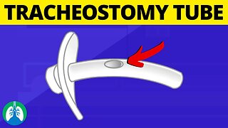 Tracheostomy Tube (Medical Definition) | Quick Explainer Video