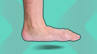 How To Get Rid Of Flat Feet
