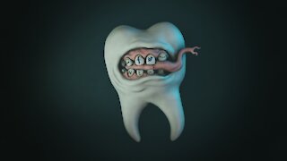 202129.Crooked teeth - Karma