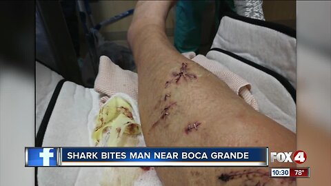 Shark bites man near Boca Grande