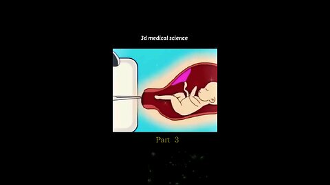 SURGICAL ABORTION PROCEDURE