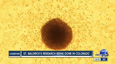 St. Baldrick's Foundation funding pediatric cancer research at University of Colorado