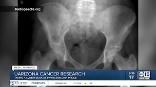 UArizona scientists working to crack the cancer code