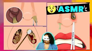 ASMR Nose Mucus Deep Cleaning Animation Massive Booger Removal