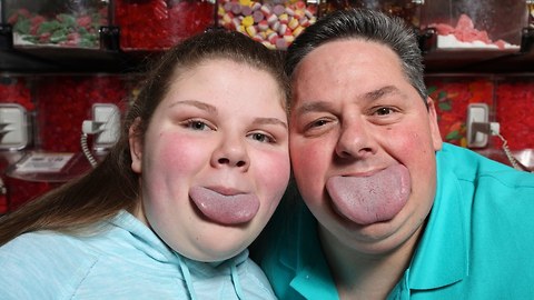 Guinness World Record: Father and Daughter Have World's Widest Tongues