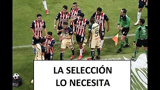 La Liga MX SÍ tiene que MEJORAR