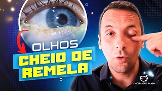 Remela nos olhos da criança gripada? Assista e saiba como resolver de uma vez por todas!