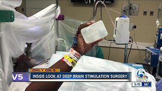 Life-changing surgery for Parkinson's tremors offered in Delray Beach