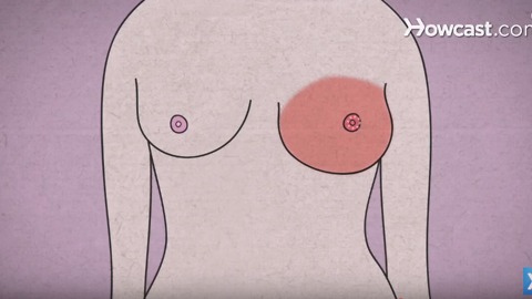 Breast Cancer Symptoms Everyone Needs to Know