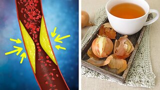 You Won't Believe What Onion Peels Can Do For Your Health!