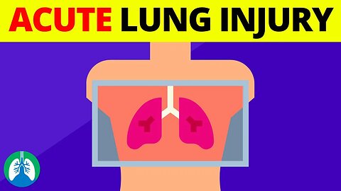 Acute Lung Injury (ALI) | Medical Definition