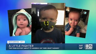 Two-year-old boy about to undergo third heart surgery