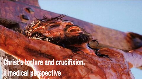 Christ's torture and crucifixion, a medical perspective