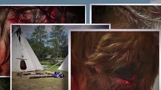 Bear attacks 19-year-old camp staffer