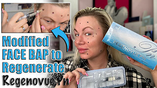 Modified BAP to Regenerate your Face with Regenovue PN, AceCosm | Code Jessica10 Saves you Money