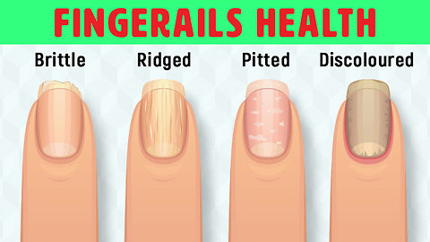 8 Things Your Nails Can Tell You About Your Health