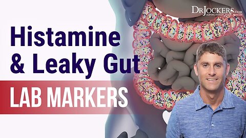 Histamine and Leaky Gut Lab Markers