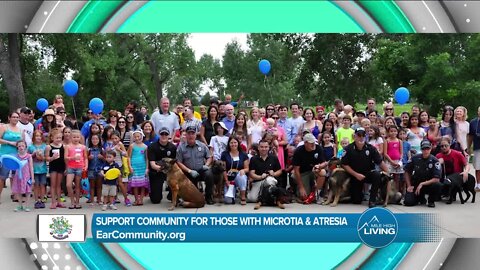 Microtia & Artesia Support // Ear Community