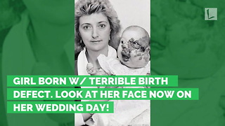 Girl Born w/ Terrible Birth Defect. Look at Her Face Now on Her Wedding Day!