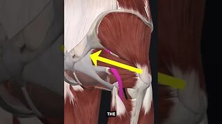 This is How You STOP Piriformis Syndrome Fast Better Than PT’s