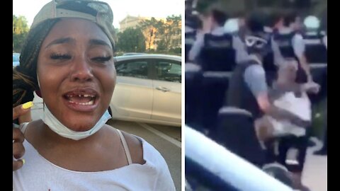 Protester claims Chicago police knocked out her front teeth, video is inconclusive