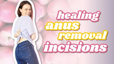 Healing My An*s Removal Surgery Incision | Let's Talk IBD