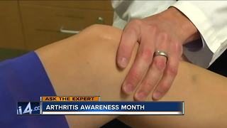 Ask the Expert: Arthritis awareness month