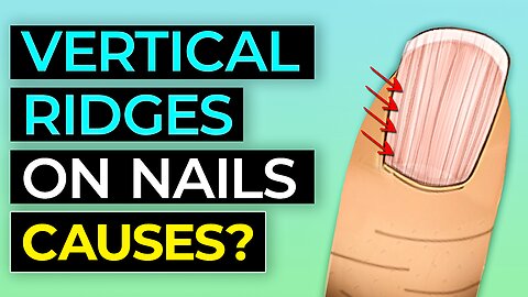 10 ALARMING Things Your Nails Is Warning You About Your HEALTH!