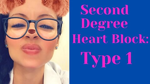 SECOND DEGREE HEART BLOCK: TYPE 1: HOW TO IDENTIFY: "Rap to remember"