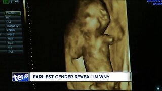 Boy or Girl? The earliest gender reveal available in Western New York