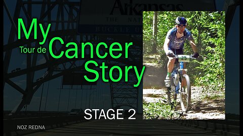 My (tour de) Cancer Story - Stage 2 (Surgery)