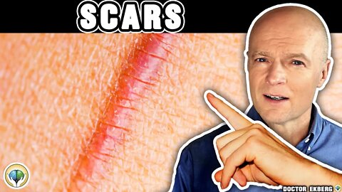 Scars Can Give You Health Issues Decades Later - Dr. Ekberg