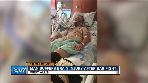 West Allis man clings to life after bar fight