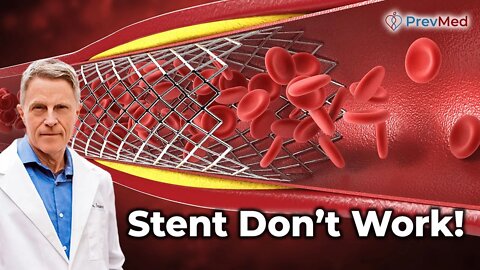 Do you know how to Prevent a Heart Attack? Hint: You don't need a Stent