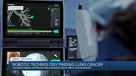 Robotic Technology Finding Lung Cancer