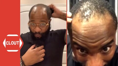 Charlamagne Tha God Reveals His Hairline During Quarantine!