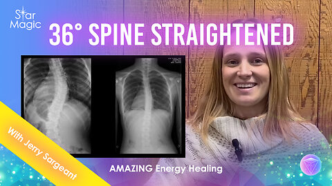 Energy Healing | Radical Spine Alignment | Kyphoscoliosis Healed