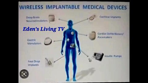 Wireless Medical Devices _ Implantable EDEN'S LIVING TV