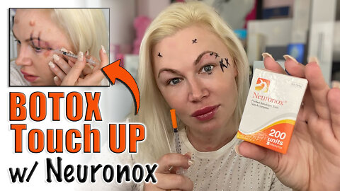 Botox Touch up with Neuronox from Maypharm.net | Code Jessica10 Saves you Money!