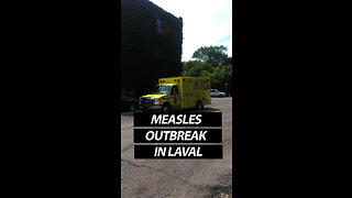 Measles Outbreak In Laval