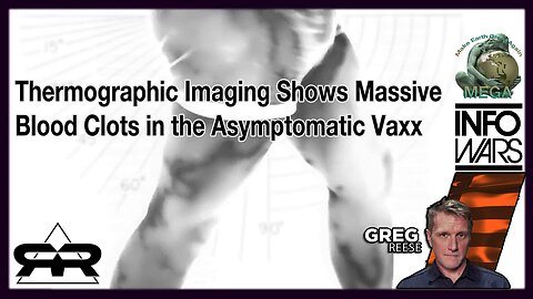 Thermographic Imaging Shows Massive Blood Clots in the Asymptomatic Vaxx