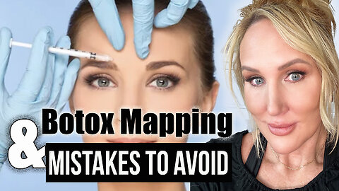 Full Face Botox Mapping & Mistakes to Avoid