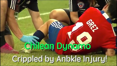 Chilean Dynamo Crippled by Ankle Injury!