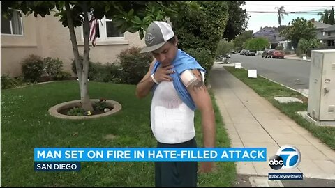San Diego Man Claimed He Was Set On Fire Because He's Gay; CCTV Shows a Different Story